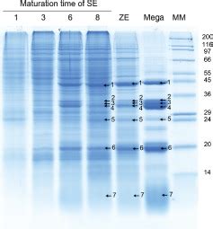 Representative SDS PAGE Total Protein Profile At Different Stages In