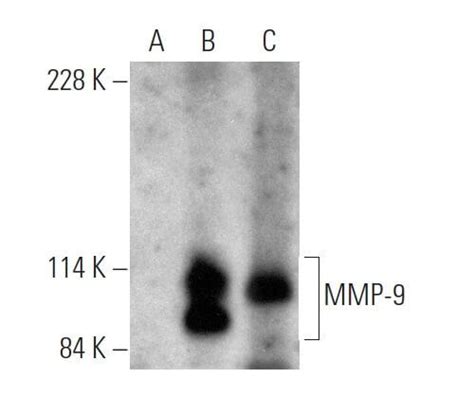 MMP 9 Antibody H 129 SCBT Santa Cruz Biotechnology