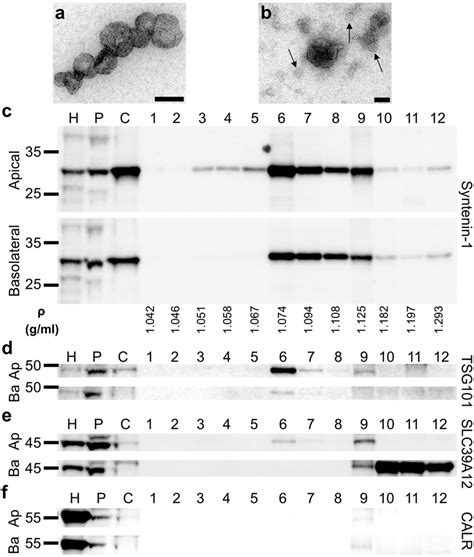 Electron Microscopic And Immunoblotting Characterization Of Exosome