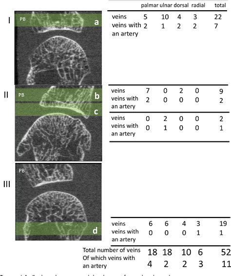 Figure 2 1 From High Resolution Peripheral Quantitative Computed