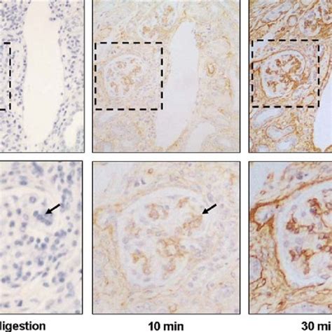 2 Examples Of Pim And Glut 1 Chromogenic IHC Staining In A Spontaneous