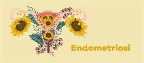 Posso Rimanere Incinta Se Ho L Endometriosi IVF Spain