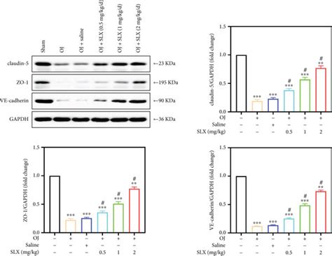 The Effect Of Slx On Protein Expression Of Claudin Zo And