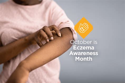 Eczema Awareness Month