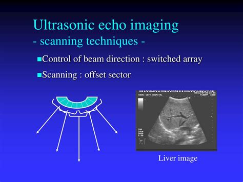 Ppt Foundations Of Medical Ultrasonic Imaging Powerpoint Presentation