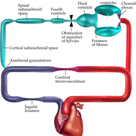 Classification Of Hydrocephalus Based On The Concept Of A Circuit Download Scientific Diagram