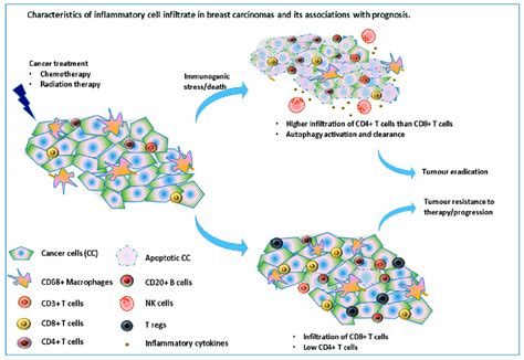 Immune Cell Infiltrate In Breast Carcinomas And Its Associations With