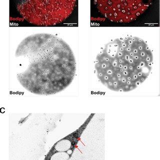 Ab Confocal Images Of Isolated Adipocytes Stained With MitoTracker