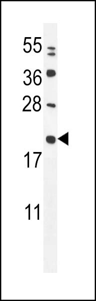Mia40 Antibody Cat No 55 895 Prosci
