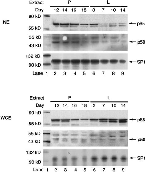 Presence Of Nf B P50 And P65 In The Nucleus During Pregnancy And