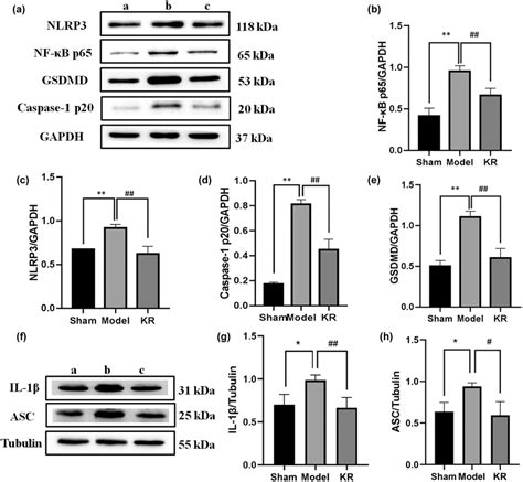 KR regulates protein expressions of NFκB NLRP3 Caspase1 pathway a