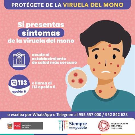 Viruela Del Mono En Per Cu Les Son Los S Ntomas Caracter Sticas Y