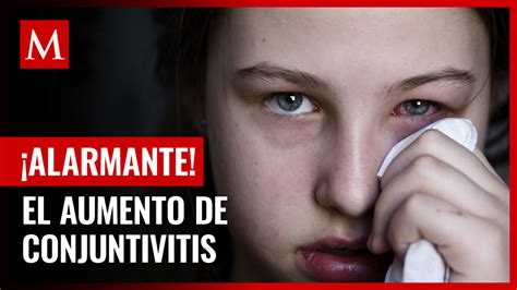 Casos De Conjuntivitis Tamaulipas Tercer Lugar En México En 2024