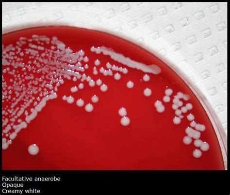 Staphylococcus saprophyticus ~ Everything You Need to Know with Photos | Videos