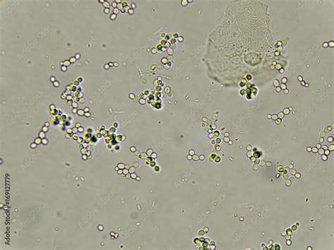 Candida In Urine