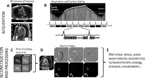 Acquisition And Reconstruction Of Aortic D Flow Data A D Imaging