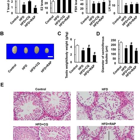 Suppressing Autophagy By CQ Ameliorated HFD Induced Spermatogenesis