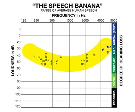 What Is An Audiogram And How To Read It