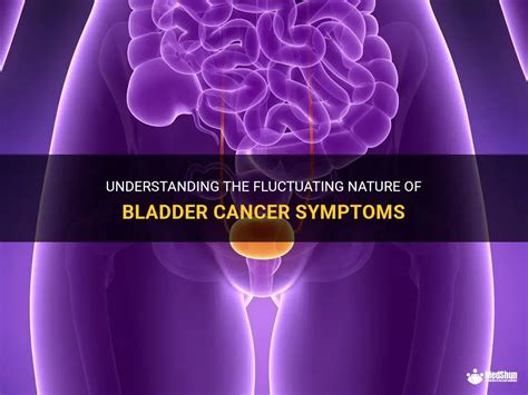 Understanding The Fluctuating Nature Of Bladder Cancer Symptoms | MedShun