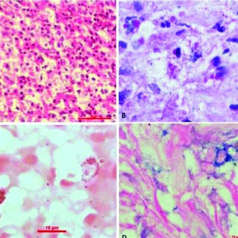 A Panel Of Representative Photomicrographs Showing A High Power