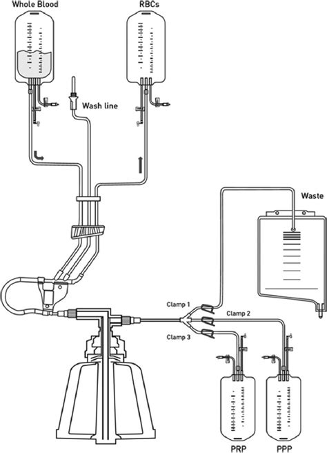 Schematic Illustration Of The Apheresis Cycle Download Scientific