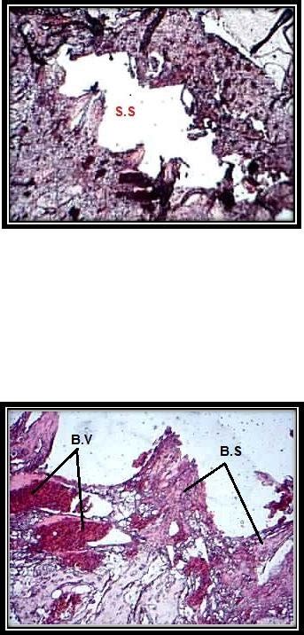 15: Higher magnification of previous figure (3.14) showing Bone... | Download Scientific Diagram