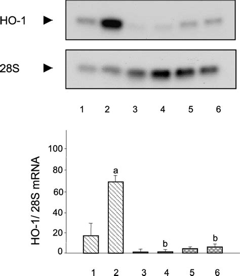 Effect Of Actinomycin D Or Cycloheximide On Acth Dependent Induction Of