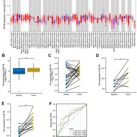 NFYB Is Highly Expressed In Gastric Cancer Tissues A The Expression