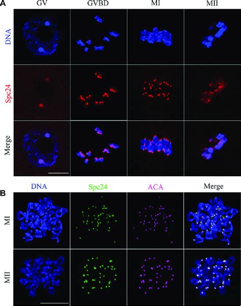 Subcellular Localization Of Spc During Mouse Oocyte Meiotic