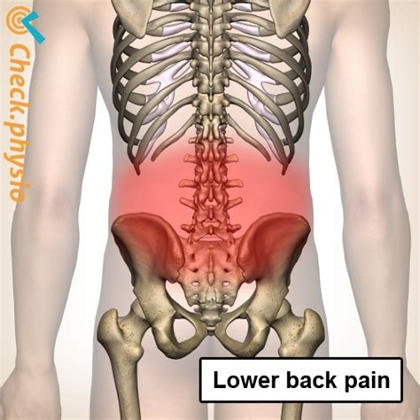 Specific lower back pain | Physio Check