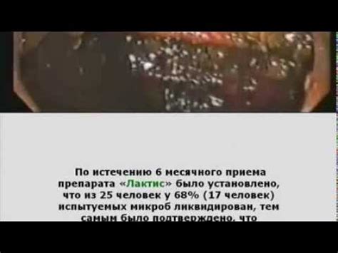 Как влияет экстракт молочнокислых бактерий на Хеликобактер Пилори -от ...