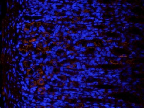 TLR4 Antibody Biorbyt