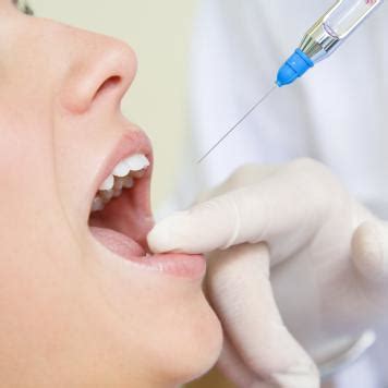 Anestesia Dentista Quanto Dura La Durata Dell Effetto