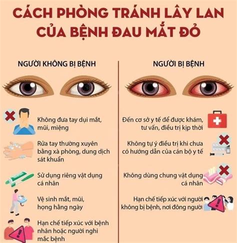 700 Trẻ Em Mắc Phải Triệu Chứng Mắt đỏ Và Nhập Viện Điều Gì đang Xảy Ra