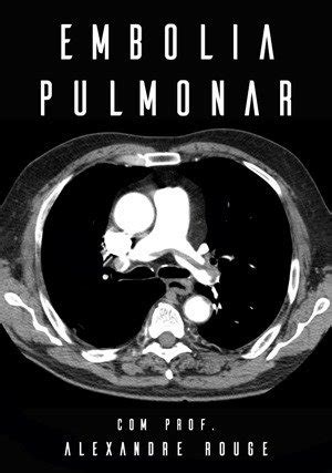 Assista Online Embolia Pulmonar Medstream