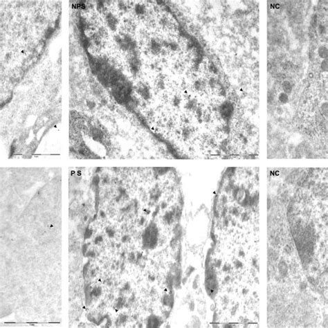 Histomorphological Features Of The Luminal And Glandular Epithelium