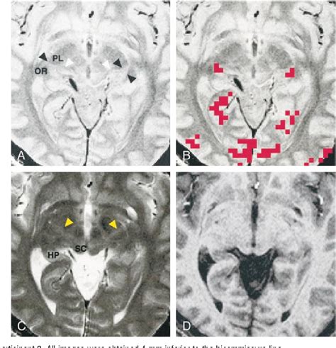 Figure 1 from Lateral geniculate nucleus: anatomic and functional ...