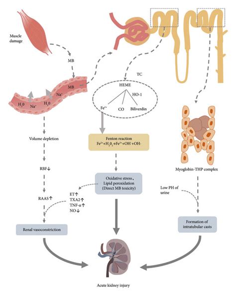 Pathophysiology Of Rhabdomyolysis Included Acute Kidney Injury Mb