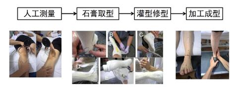 上海交通大学医学院附属第九人民医院3d打印接诊中心推出定制矫形器服务 东西智库