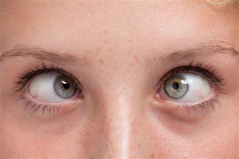 293 Cross Eyed Girl Stock Photos Free And Royalty Free Stock Photos