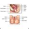 Biopsia En Cono Medlineplus Enciclopedia M Dica