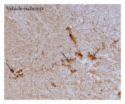 Immunohistochemical Staining For Cd11b In The Ventral Horn Of The L5 L6