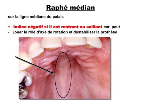 Les Indices Biologiques Pdf