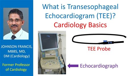 What Is Transesophageal Echocardiogram Tee Cardiology Basics Youtube