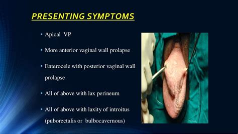 Vault Prolapse Pelvic Organ Prolapse Supports Of Uterus