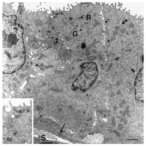 Transmission Electron Micrograph Of Endometrial Epithelial Cells