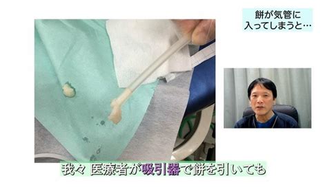 餅が喉に詰まったら 座った状態で背中を叩いてはダメ！生死を分ける4分間にやるべき3つの処置を徹底解説 名医のいる相談室｜fnnプライムオンライン