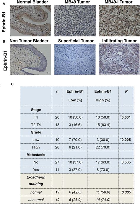 Immunohistochemical Analysis Of Ephrin B In Murine And Human Bladder