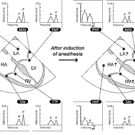 Left And Right Ventricular Diastolic Function Download Scientific Diagram