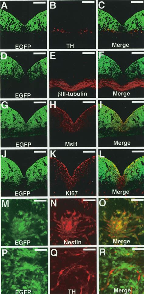 Isolation Of Nestin Gfp Cells From The Embryonic Vm Ac